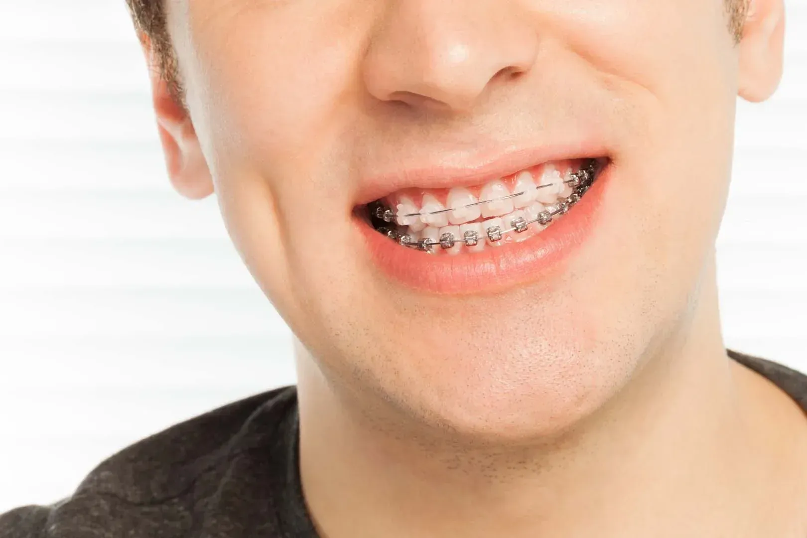 Braces & Orthodontic Care in El Dorado Hills