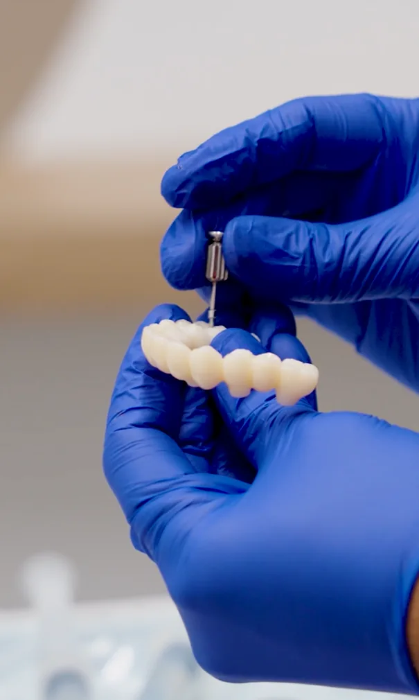 From Single Tooth to Full-Arch Restoration