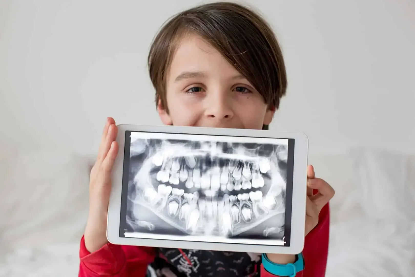Dental X-Rays & Imaging