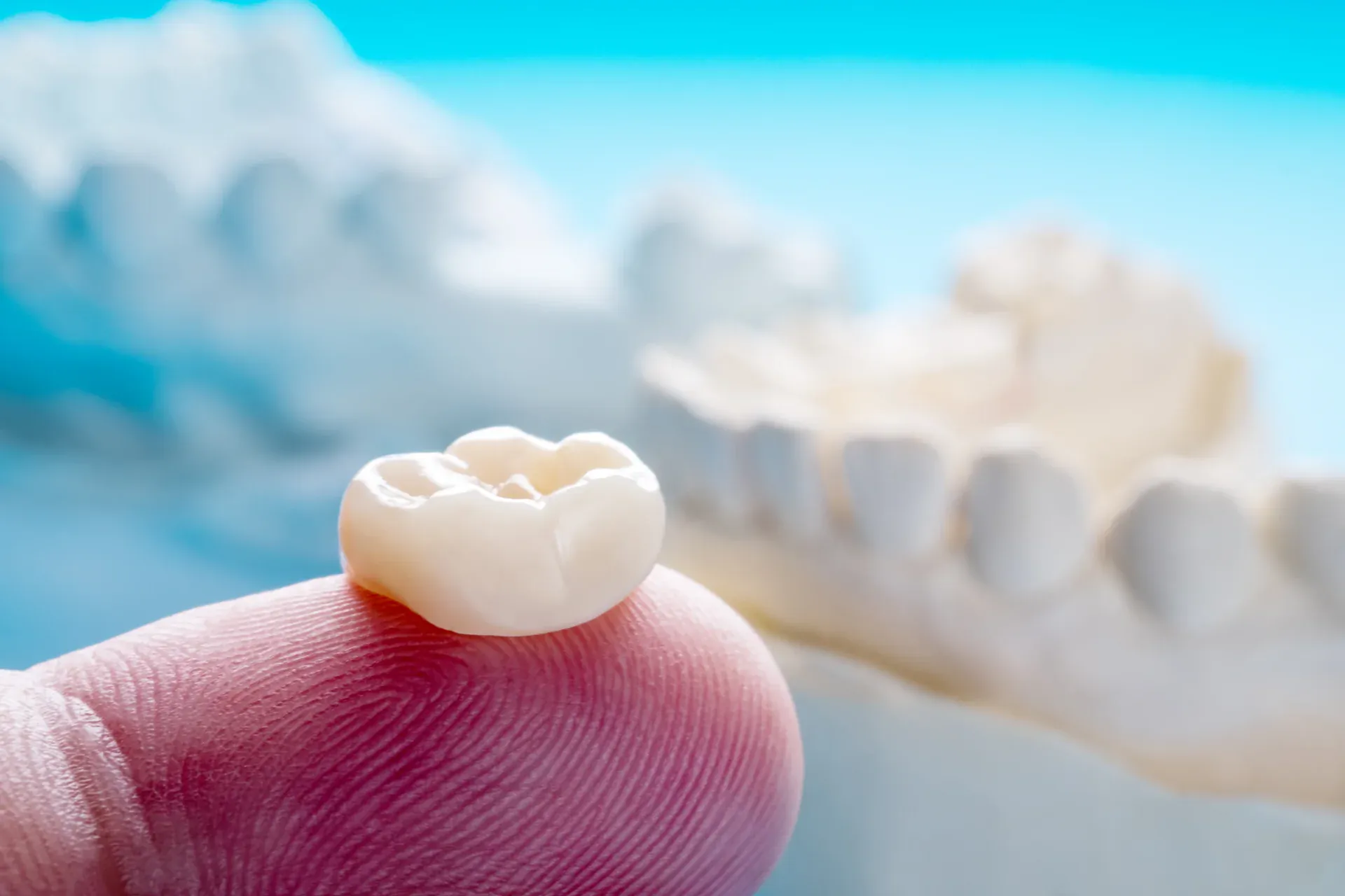 Same-day ceramic crown restoration