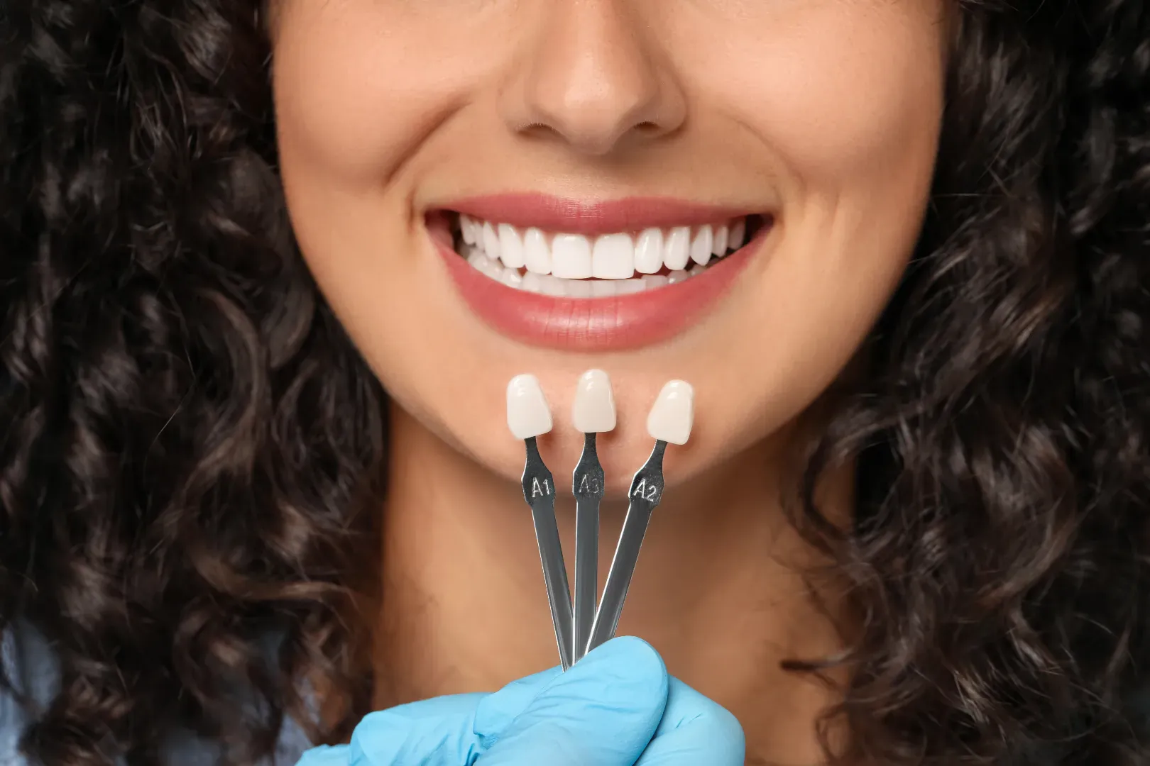Veneers & Smile Makeovers